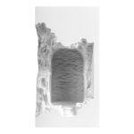 Настенные светильники Loft It 10355C Antique
